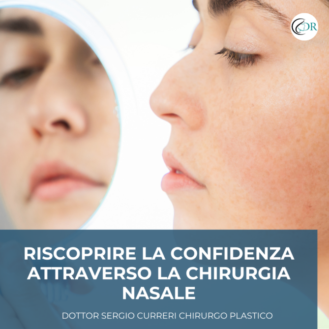 Riscoprire la confidenza attraverso la chirurgia nasale