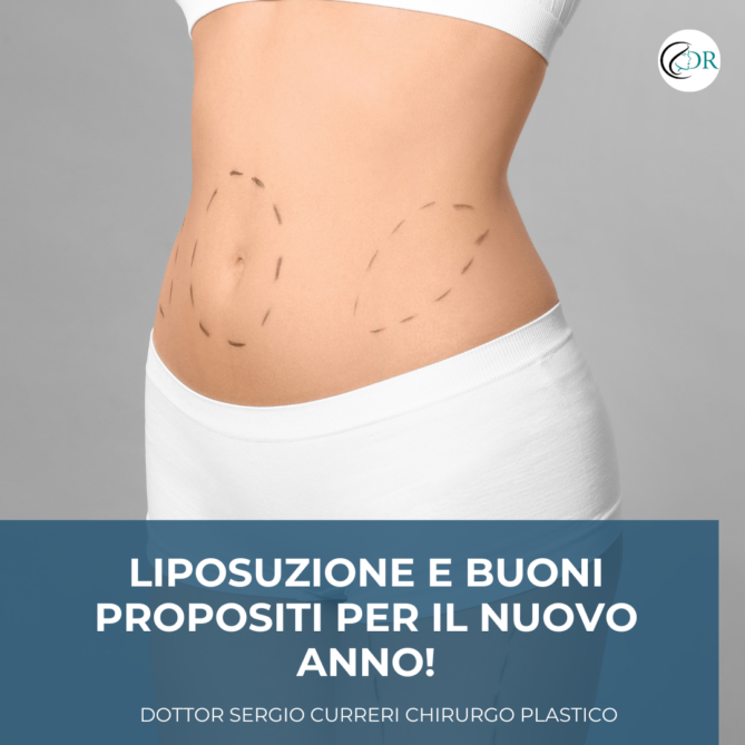 Liposuzione e buoni propositi per il nuovo anno